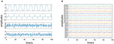 Disentangling dynamic and stochastic modes in multivariate time series